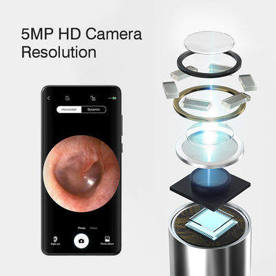 3.9mm HD Otoskop Telinga WiFi Digital dengan Fungsi Arah AI dan Konektivitas WiFi