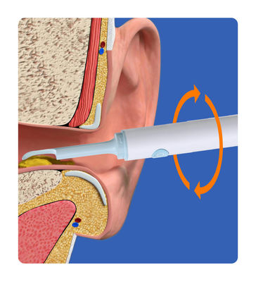 Smart Visual Ear Cleaning Rod Kamera Medis Endoskop untuk Bahan Kimia Rumah Tangga Lainnya